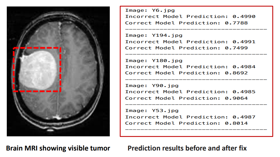 Brain MRI before and after fix